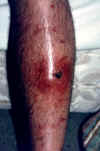 that's how my leg looked like